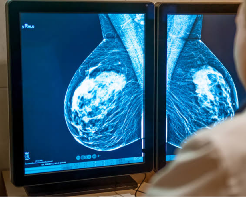 Almost half of women have dense breasts. So why are so few told
